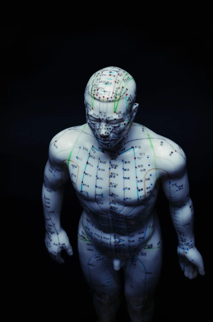 Acupuncture